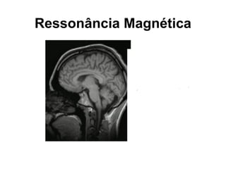 Ressonância Magnética
 