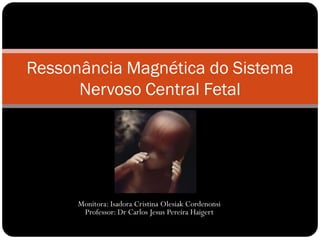 Monitora: Isadora Cristina Olesiak Cordenonsi
Professor: Dr Carlos Jesus Pereira Haigert
Ressonância Magnética do Sistema
Nervoso Central Fetal
 