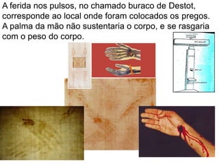 A ferida nos pulsos, no chamado buraco de Destot,
corresponde ao local onde foram colocados os pregos.
A palma da mão não sustentaria o corpo, e se rasgaria
com o peso do corpo.
 
