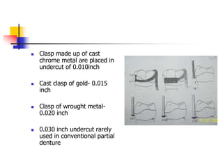  Clasp made up of cast
chrome metal are placed in
undercut of 0.010inch
 Cast clasp of gold- 0.015
inch
 Clasp of wrought metal-
0.020 inch
 0.030 inch undercut rarely
used in conventional partial
denture
 