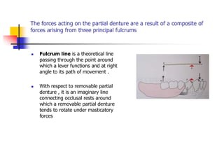 The forces acting on the partial denture are a result of a composite of
forces arising from three principal fulcrums
 Fulcrum line is a theoretical line
passing through the point around
which a lever functions and at right
angle to its path of movement .
 With respect to removable partial
denture , it is an imaginary line
connecting occlusal rests around
which a removable partial denture
tends to rotate under masticatory
forces
 