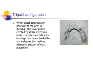 Tripoid configuration
 When distal abutment on
one side of the arch is
missing , the lever arm is
created by distal extension
bone . In this circumstances
leverage can be controlled to
some degree by creating
triangular pattern of clasp
placement
 