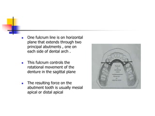  One fulcrum line is on horizontal
plane that extends through two
principal abutments , one on
each side of dental arch .
 This fulcrum controls the
rotational movement of the
denture in the sagittal plane
 The resulting force on the
abutment tooth is usually mesial
apical or distal apical
 