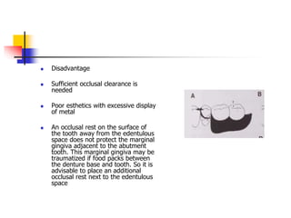  Disadvantage
 Sufficient occlusal clearance is
needed
 Poor esthetics with excessive display
of metal
 An occlusal rest on the surface of
the tooth away from the edentulous
space does not protect the marginal
gingiva adjacent to the abutment
tooth. This marginal gingiva may be
traumatized if food packs between
the denture base and tooth. So it is
advisable to place an additional
occlusal rest next to the edentulous
space
 