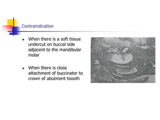 Contraindication
 When there is a soft tissue
undercut on buccal side
adjacent to the mandibular
molar
 When there is close
attachment of buccinator to
crown of abutment toooth
 