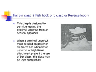 Hairpin clasp ( Fish hook or c clasp or Reverse loop )
 This clasp is designed to
permit engaging the
proximal undercut from an
occlusal approach
 When a proximal undercut
must be used on posterior
abutment and when tissue
undercut or high tissue
attachment prevent the use
of bar clasp , this clasp may
be used successfully
 
