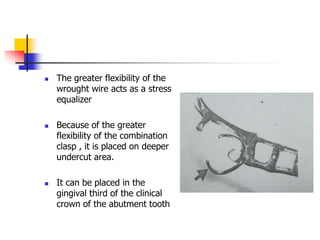  The greater flexibility of the
wrought wire acts as a stress
equalizer
 Because of the greater
flexibility of the combination
clasp , it is placed on deeper
undercut area.
 It can be placed in the
gingival third of the clinical
crown of the abutment tooth
 
