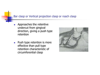 Bar clasp or Vertical projection clasp or roach clasp
 Approaches the retentive
undercut from gingival
direction, giving a push type
retention
 Push type retention is more
effective than pull type
retention characteristic of
circumferential clasp
 