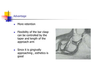 Advantage
 More retention
 Flexibility of the bar clasp
can be controlled by the
taper and length of the
approach arm
 Since it is gingivally
approaching , esthetics is
good
 