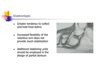 Disadvantages
 Greater tendency to collect
and hold food debris
 Increased flexibility of the
retentive arm does not
provide much stabilization
 Additional stabilizing units
should be employed in the
design of partial denture
 