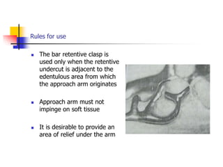 Rules for use
 The bar retentive clasp is
used only when the retentive
undercut is adjacent to the
edentulous area from which
the approach arm originates
 Approach arm must not
impinge on soft tissue
 It is desirable to provide an
area of relief under the arm
 