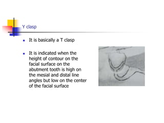 Y clasp
 It is basically a T clasp
 It is indicated when the
height of contour on the
facial surface on the
abutment tooth is high on
the mesial and distal line
angles but low on the center
of the facial surface
 