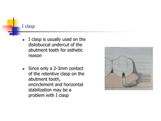 I clasp
 I clasp is usually used on the
distobuccal undercut of the
abutment tooth for esthetic
reason
 Since only a 2-3mm contact
of the retentive clasp on the
abutment tooth,
encirclement and horizontal
stabilization may be a
problem with I clasp
 