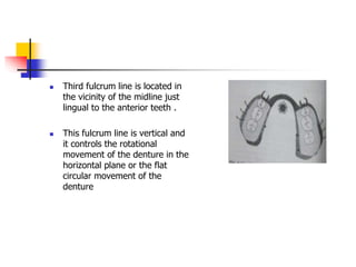  Third fulcrum line is located in
the vicinity of the midline just
lingual to the anterior teeth .
 This fulcrum line is vertical and
it controls the rotational
movement of the denture in the
horizontal plane or the flat
circular movement of the
denture
 