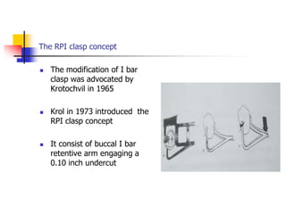 The RPI clasp concept
 The modification of I bar
clasp was advocated by
Krotochvil in 1965
 Krol in 1973 introduced the
RPI clasp concept
 It consist of buccal I bar
retentive arm engaging a
0.10 inch undercut
 