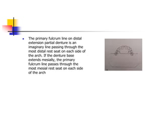  The primary fulcrum line on distal
extension partial denture is an
imaginary line passing through the
most distal rest seat on each side of
the arch. If the denture base
extends mesially, the primary
fulcrum line passes through the
most mesial rest seat on each side
of the arch
 