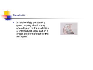 Site selection
 A suitable clasp design for a
given clasping situation may
often depend on the availability
of interocclusal space and on a
proper site on the tooth for the
rest recess.
 