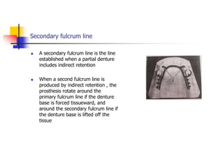 Secondary fulcrum line
 A secondary fulcrum line is the line
established when a partial denture
includes indirect retention
 When a second fulcrum line is
produced by indirect retention , the
prosthesis rotate around the
primary fulcrum line if the denture
base is forced tissueward, and
around the secondary fulcrum line if
the denture base is lifted off the
tissue
 
