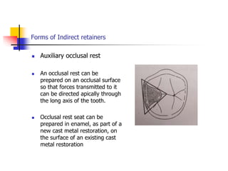 Forms of Indirect retainers
 Auxiliary occlusal rest
 An occlusal rest can be
prepared on an occlusal surface
so that forces transmitted to it
can be directed apically through
the long axis of the tooth.
 Occlusal rest seat can be
prepared in enamel, as part of a
new cast metal restoration, on
the surface of an existing cast
metal restoration
 