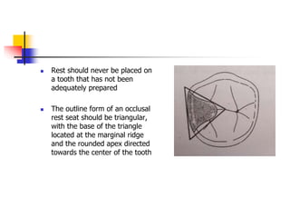 Rest should never be placed on
a tooth that has not been
adequately prepared
 The outline form of an occlusal
rest seat should be triangular,
with the base of the triangle
located at the marginal ridge
and the rounded apex directed
towards the center of the tooth
 
