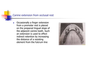 Canine extension from occlusal rest
 Occasionally a finger extension
from a premolar rest is placed
on the prepared lingual slope of
the adjacent canine tooth. Such
an extension is used to effect
indirect retention by increasing
the distance of a resisting
element from the fulcrum line
 