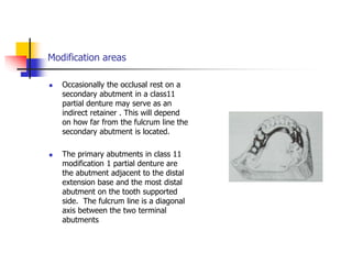 Modification areas
 Occasionally the occlusal rest on a
secondary abutment in a class11
partial denture may serve as an
indirect retainer . This will depend
on how far from the fulcrum line the
secondary abutment is located.
 The primary abutments in class 11
modification 1 partial denture are
the abutment adjacent to the distal
extension base and the most distal
abutment on the tooth supported
side. The fulcrum line is a diagonal
axis between the two terminal
abutments
 