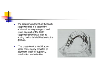 The anterior abutment on the tooth
supported side is a secondary
abutment serving to support and
retain one end of the tooth
supported segment as well as
adding horizontal stabilization to the
denture.
 The presence of a modification
space conveniently provides an
abutment tooth for support ,
stabilization and retention
 