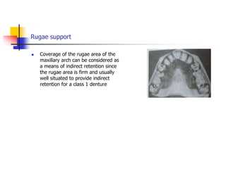 Rugae support
 Coverage of the rugae area of the
maxillary arch can be considered as
a means of indirect retention since
the rugae area is firm and usually
well situated to provide indirect
retention for a class 1 denture
 