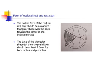Form of occlusal rest and rest seat
 The outline form of the occlusal
rest seat should be a rounded
triangular shape with the apex
towards the center of the
occlusal surface
 The base of the triangular
shape (at the marginal ridge)
should be at least 2.5mm for
both molars and premolars
 