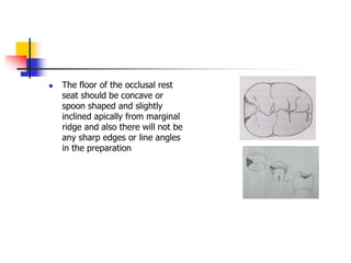  The floor of the occlusal rest
seat should be concave or
spoon shaped and slightly
inclined apically from marginal
ridge and also there will not be
any sharp edges or line angles
in the preparation
 