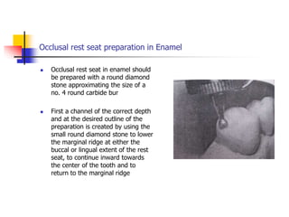 Occlusal rest seat preparation in Enamel
 Occlusal rest seat in enamel should
be prepared with a round diamond
stone approximating the size of a
no. 4 round carbide bur
 First a channel of the correct depth
and at the desired outline of the
preparation is created by using the
small round diamond stone to lower
the marginal ridge at either the
buccal or lingual extent of the rest
seat, to continue inward towards
the center of the tooth and to
return to the marginal ridge
 