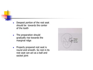  Deepest portion of the rest seat
should be towards the center
of the tooth
 The preparation should
gradually rise towards the
marginal ridge
 Properly prepared rest seat is
round and smooth. So rest in its
rest seat can act as a ball and
socket joint
 