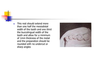  This rest should extend more
than one half the mesiodistal
width of the tooth and one third
the buccolingual width of the
tooth and allow for a minimum
of 1mm thickness of the metal
and the preparation should be
rounded with no undercut or
sharp angles
 