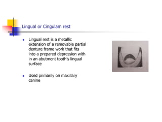 Lingual or Cingulam rest
 Lingual rest is a metallic
extension of a removable partial
denture frame work that fits
into a prepared depression with
in an abutment tooth’s lingual
surface
 Used primarily on maxillary
canine
 