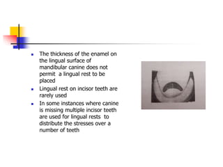  The thickness of the enamel on
the lingual surface of
mandibular canine does not
permit a lingual rest to be
placed
 Lingual rest on incisor teeth are
rarely used
 In some instances where canine
is missing multiple incisor teeth
are used for lingual rests to
distribute the stresses over a
number of teeth
 