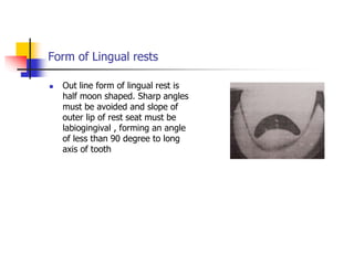 Form of Lingual rests
 Out line form of lingual rest is
half moon shaped. Sharp angles
must be avoided and slope of
outer lip of rest seat must be
labiogingival , forming an angle
of less than 90 degree to long
axis of tooth
 