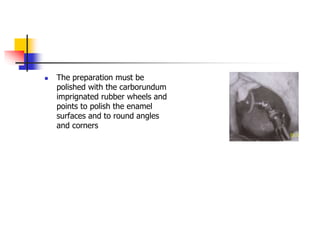  The preparation must be
polished with the carborundum
imprignated rubber wheels and
points to polish the enamel
surfaces and to round angles
and corners
 