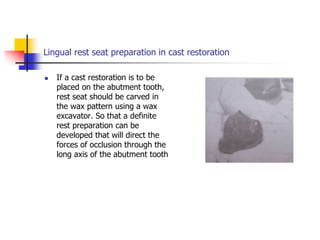 Lingual rest seat preparation in cast restoration
 If a cast restoration is to be
placed on the abutment tooth,
rest seat should be carved in
the wax pattern using a wax
excavator. So that a definite
rest preparation can be
developed that will direct the
forces of occlusion through the
long axis of the abutment tooth
 