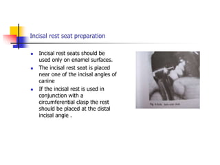 Incisal rest seat preparation
 Incisal rest seats should be
used only on enamel surfaces.
 The incisal rest seat is placed
near one of the incisal angles of
canine
 If the incisal rest is used in
conjunction with a
circumferential clasp the rest
should be placed at the distal
incisal angle .
 