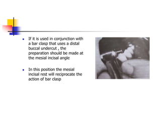  If it is used in conjunction with
a bar clasp that uses a distal
buccal undercut , the
preparation should be made at
the mesial incisal angle
 In this position the mesial
incisal rest will reciprocate the
action of bar clasp
 