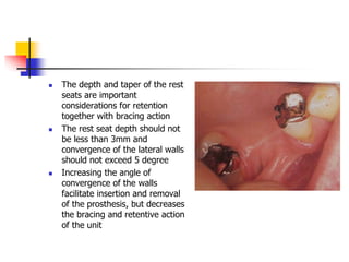  The depth and taper of the rest
seats are important
considerations for retention
together with bracing action
 The rest seat depth should not
be less than 3mm and
convergence of the lateral walls
should not exceed 5 degree
 Increasing the angle of
convergence of the walls
facilitate insertion and removal
of the prosthesis, but decreases
the bracing and retentive action
of the unit
 