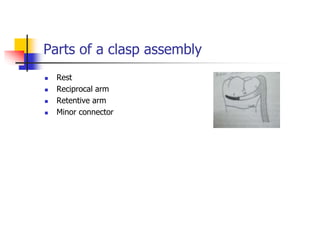 Parts of a clasp assembly
 Rest
 Reciprocal arm
 Retentive arm
 Minor connector
 