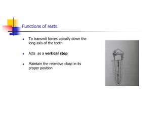 Functions of rests
 To transmit forces apically down the
long axis of the tooth
 Acts as a vertical stop
 Maintain the retentive clasp in its
proper position
 