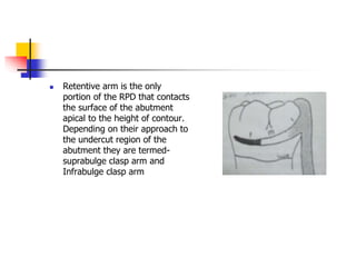  Retentive arm is the only
portion of the RPD that contacts
the surface of the abutment
apical to the height of contour.
Depending on their approach to
the undercut region of the
abutment they are termed-
suprabulge clasp arm and
Infrabulge clasp arm
 