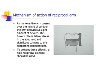 Mechanism of action of reciprocal arm
 As the retentive arm passes
over the height of contour
the arm displaces a slight
amount of flexure. This
flexure places lateral stress
in the abutment and
significant damage to the
supporting periodontium.
 To prevent these effects , a
rigid reciprocal element
should be used.
 