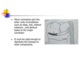  Minor connectors join the
other units of prosthesis
such as clasp, rest, indirect
retainers , and denture
bases to the major
connector.
 It must be rigid enough to
distribute the stresses to
other components.
 