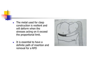  The metal used for clasp
construction is resilient and
will deform when the
stresses acting on it exceed
the proportional limit.
 It is essential to have a
definite path of insertion and
removal for a RPD
 