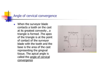 Angle of cervical convergence
 When the surveyor blade
contacts a tooth on the cast
at its greatest convexity , a
triangle is formed .The apex
of the triangle is at the point
of contact of the surveyor
blade with the tooth and the
base is the area of the cast
representing the gingival
tissue. The apical angle is
called the angle of cervical
convergence
 