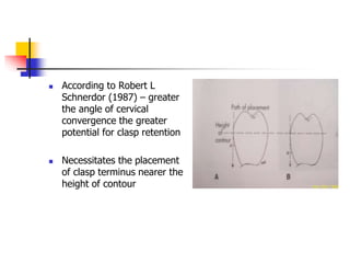  According to Robert L
Schnerdor (1987) – greater
the angle of cervical
convergence the greater
potential for clasp retention
 Necessitates the placement
of clasp terminus nearer the
height of contour
 