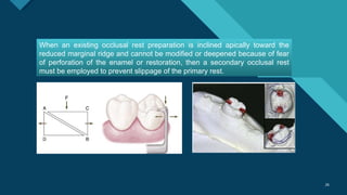 REST AND REST SEAT in removable partial dentures .pptx